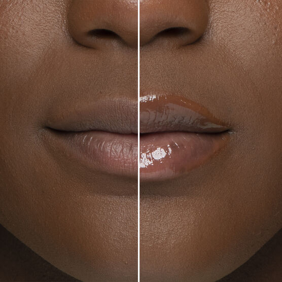 LIP INJECTION 1.5GR